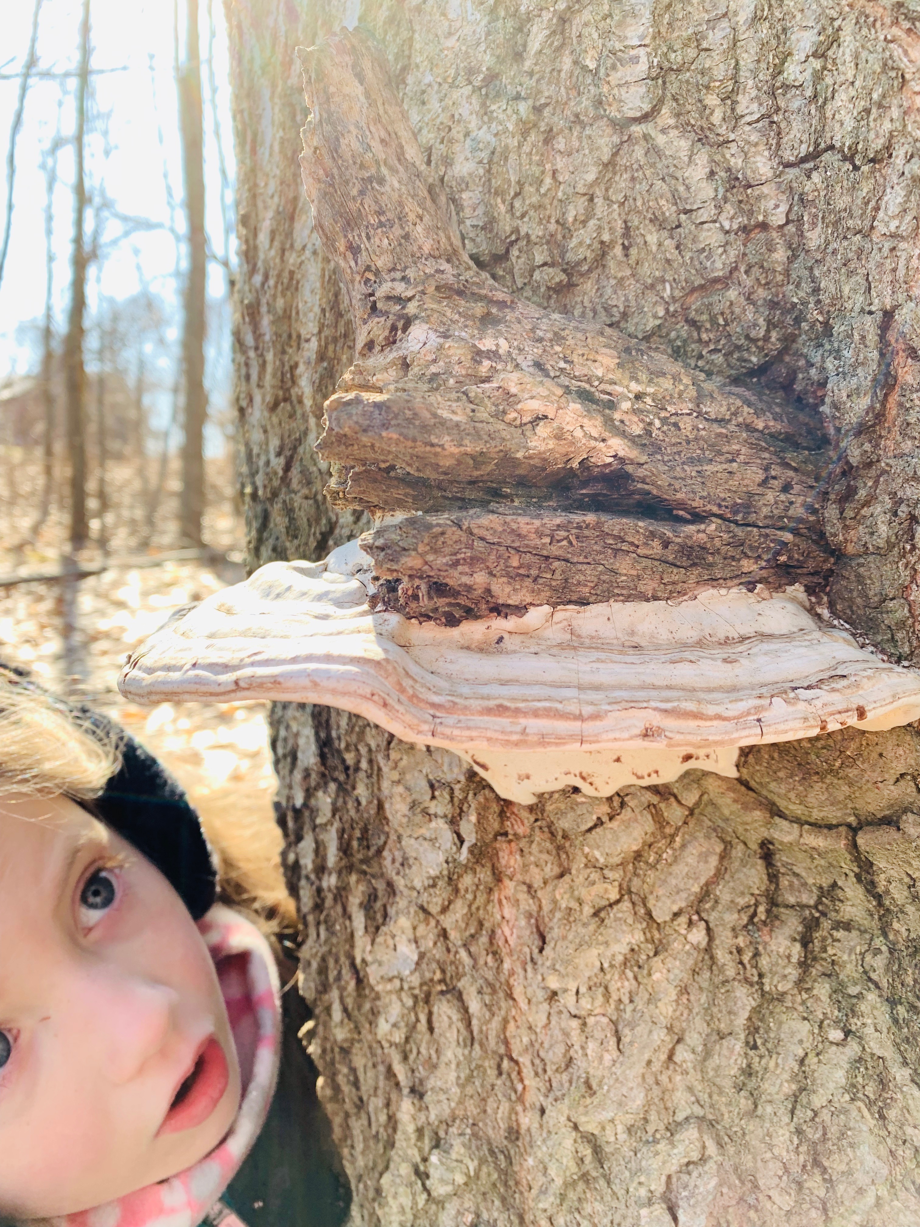 Young girl looks up at a tree trunk with bark growth 